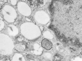 Imagen ME de un macrofago alveolar 